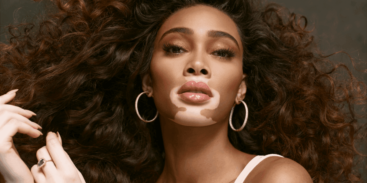 Winnie-Harlow-Blog (1)